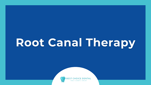 Expert Root Canal Therapy in Boca Raton, FL